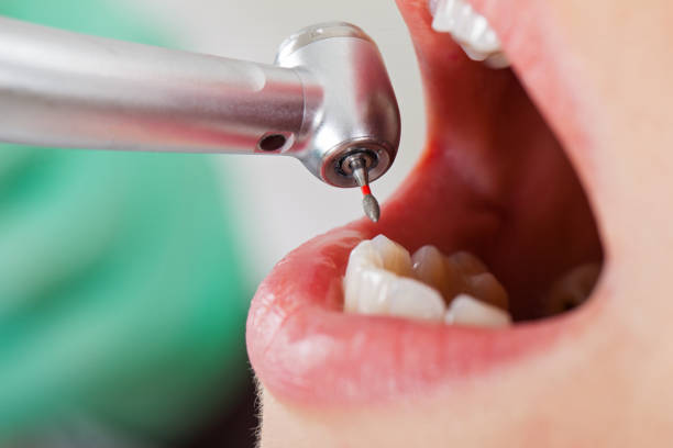 Best Walk-In Emergency Dentist in Coosada, AL